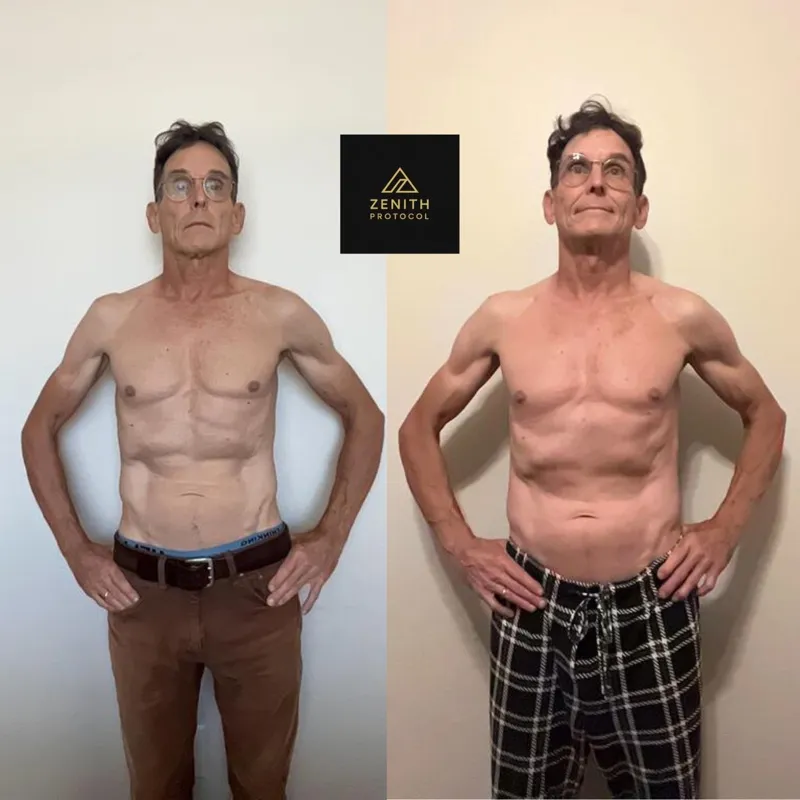 John — Before and After