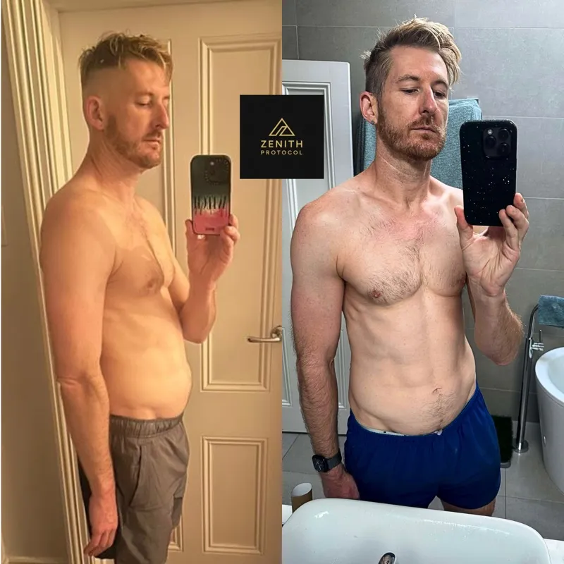 Stephen — Before and After